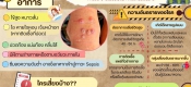 สสส โรคไข้ดิน
